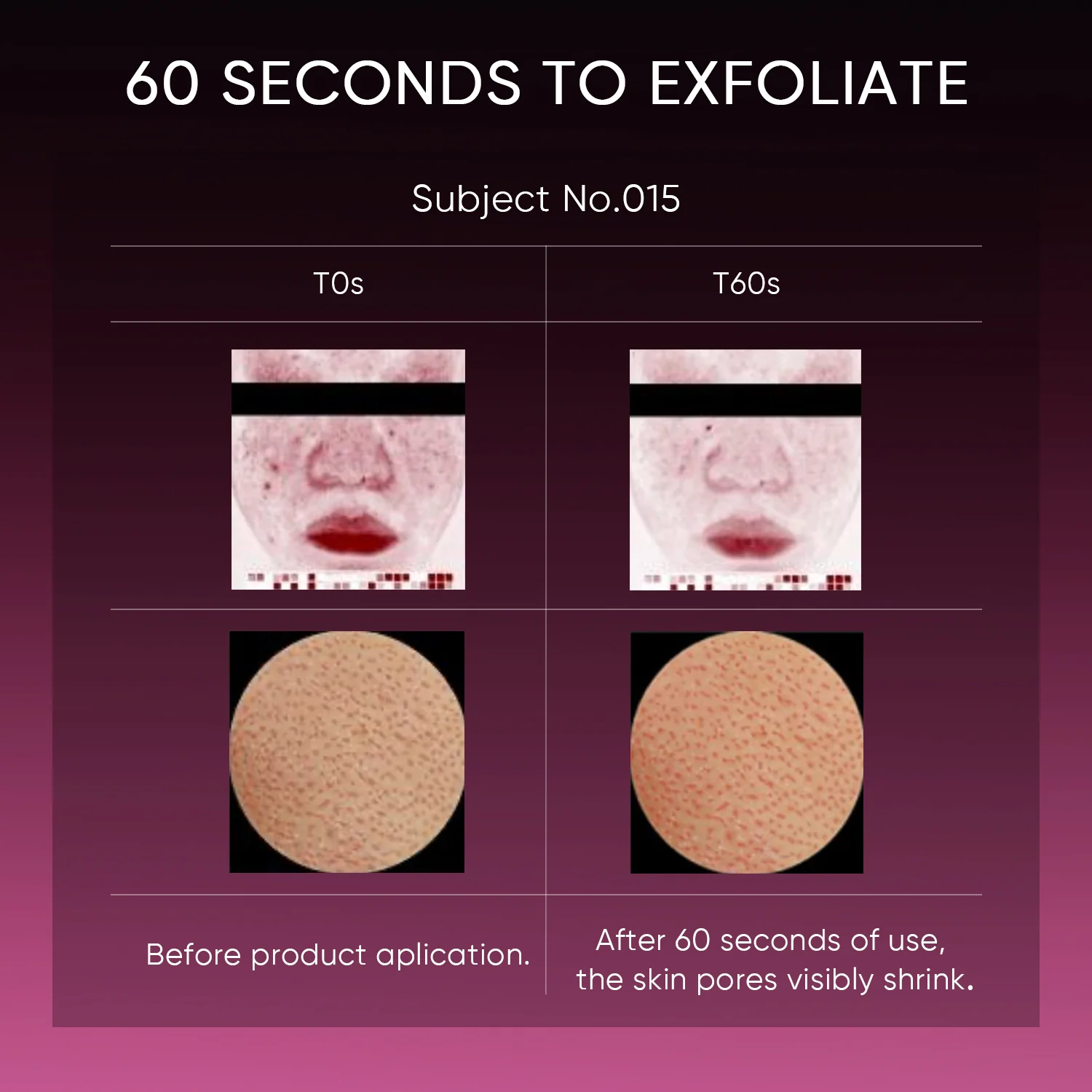 12% AHA BHA PHA LHA Peeling Solution Serum - Image 8