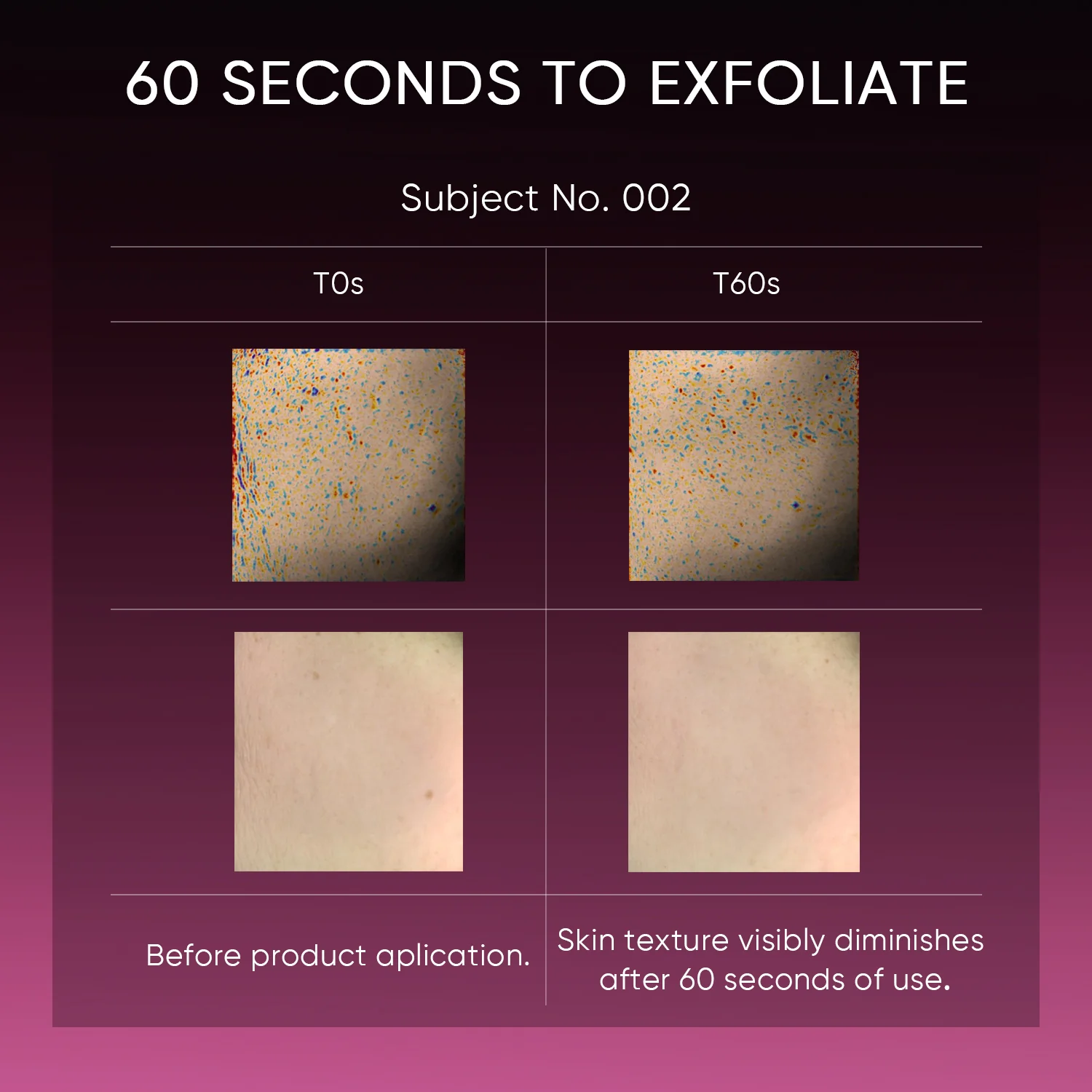 12% AHA BHA PHA LHA Peeling Solution Serum - Image 9