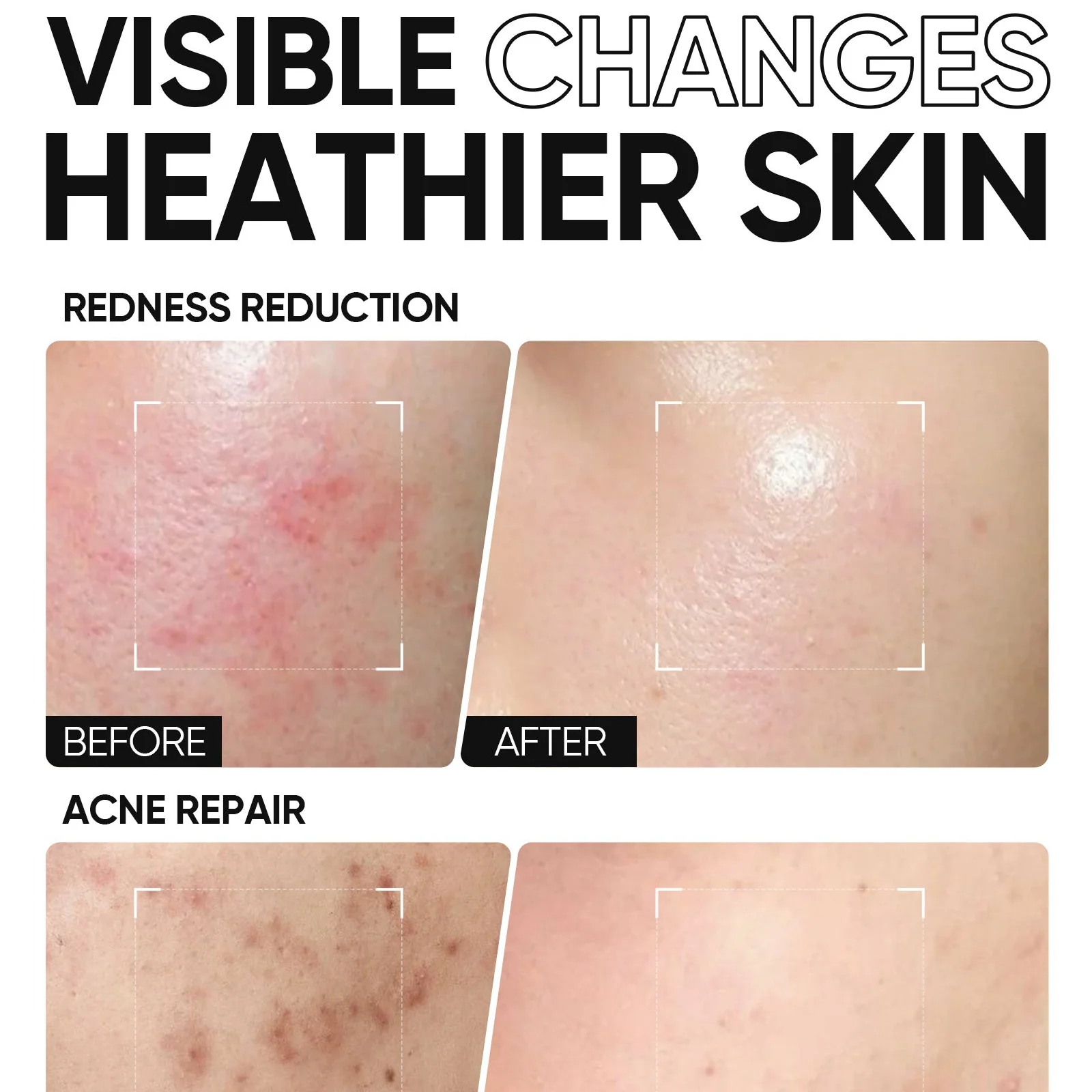 5X Ceramide Barrier Repair Moisture Gel - Image 3