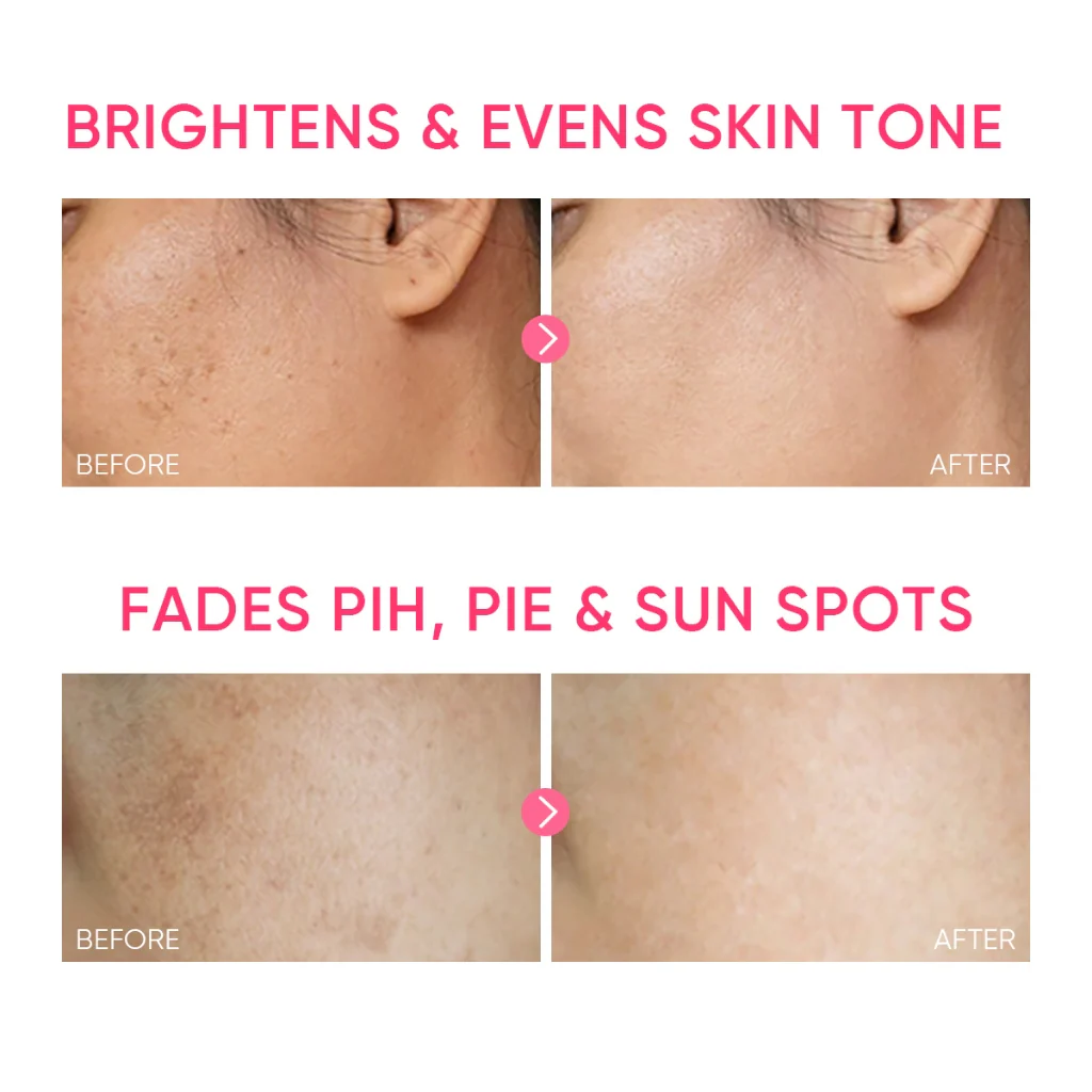MSH Niacinamide Brightening Moisture Gel - Image 7