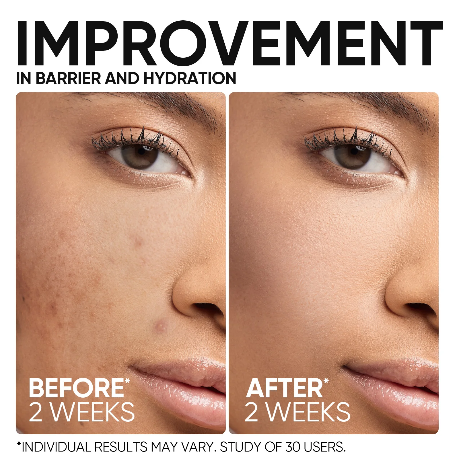5X Ceramide Skin Barrier Repair Serum - Image 4