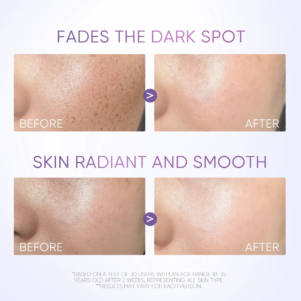SymWhite 377 Dark Spot Eraser Serum - Image 3