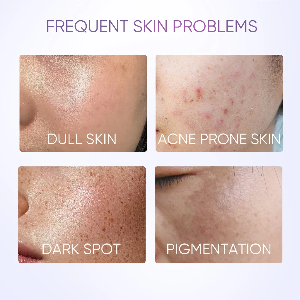 SymWhite 377 Dark Spot Eraser Serum - Image 5