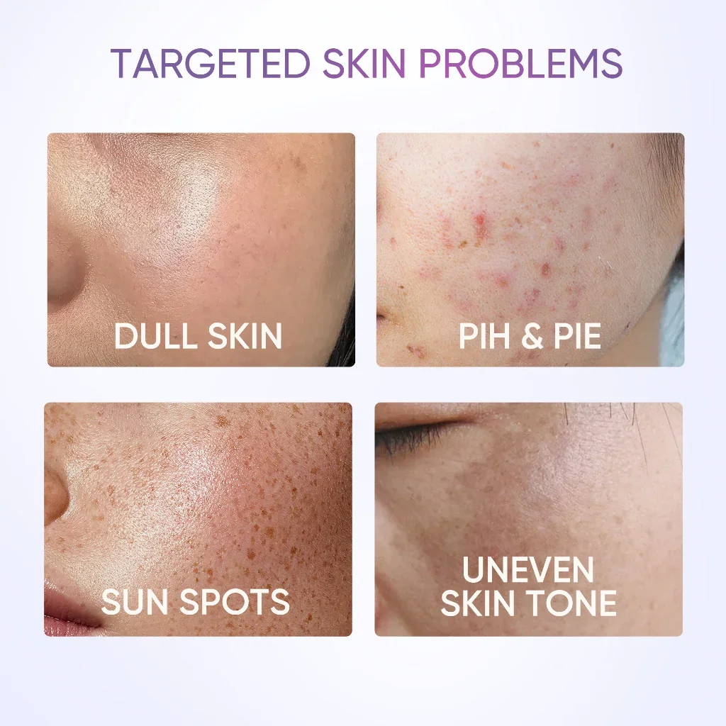 SymWhite 377 Dark Spot Moisture Gel - Image 6