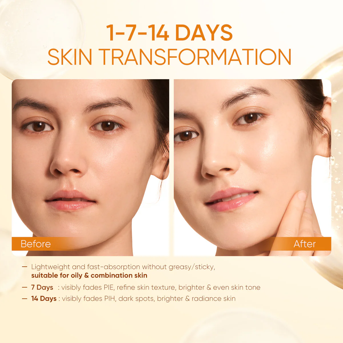 Vitamin C Brightening Set 4pcs Kit - Brightening Cleanser, Toner, Serum & Moisturizer - Dark Spot & Glow Solution - Image 3